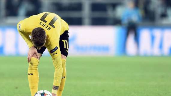 Le pagelle del B. Dortmund - Burki miracoloso, deludono i trequartisti