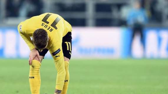 Alemania, Erdmann minimiza la lesión de Reus