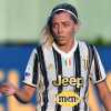Juventus Women, riduzione della frattura del setto nasale per Linda Sembrant