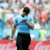 Uruguay, problema a una mano per Suarez: nulla di grave, sarà a disposizione per Iran e Canada