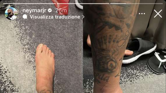 FOTO - Neymar lavora per recuperare, ma la caviglia del brasiliano fa impressione