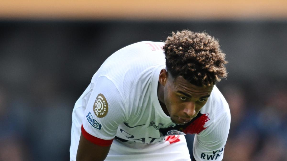 PSG, infortunio Doué (che esce in lacrime). Luis Enrique: "Non è una bella notizia"